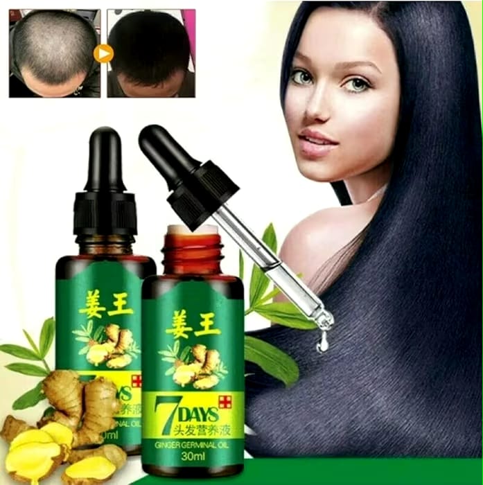 Hair Regrow 7 Day, Ginger Germinal Essential Oil Hair Growth Hair Loss Treatment Hair Care Hair Growth Serum for Men & Women, 30ml
