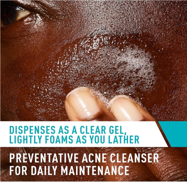 CeraVe Face Wash Acne Treatment Salicylic Acid Cleanser with Purifying Clay for Oily Skin Blackhead Remover