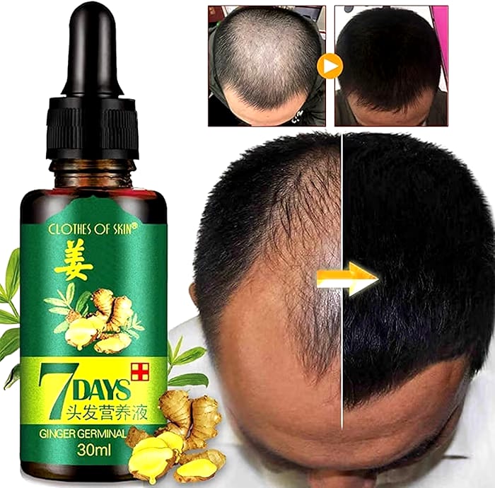 Hair Regrow 7 Day, Ginger Germinal Essential Oil Hair Growth Hair Loss Treatment Hair Care Hair Growth Serum for Men & Women, 30ml