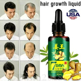Hair Regrow 7 Day, Ginger Germinal Essential Oil Hair Growth Hair Loss Treatment Hair Care Hair Growth Serum for Men & Women, 30ml