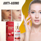 Sadoer Dragon Blood Serum
