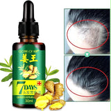 Hair Regrow 7 Day, Ginger Germinal Essential Oil Hair Growth Hair Loss Treatment Hair Care Hair Growth Serum for Men & Women, 30ml