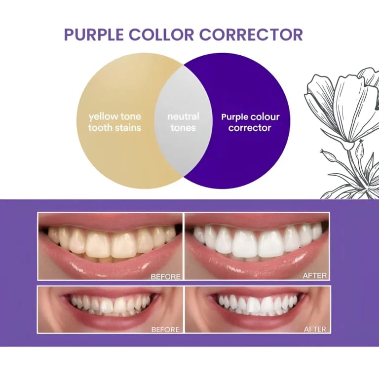 Scoban Purple Tooth Whitening Powder – 30g
