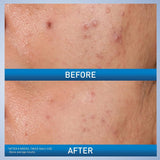 CeraVe Acne Control Gel with AHA & BHA 40ml