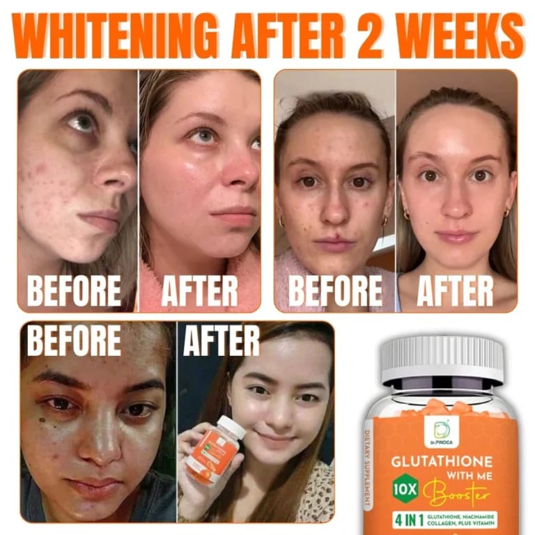 Dr. Pinoca Glutathione With Me 10X Booster – 60 Organic Gummies