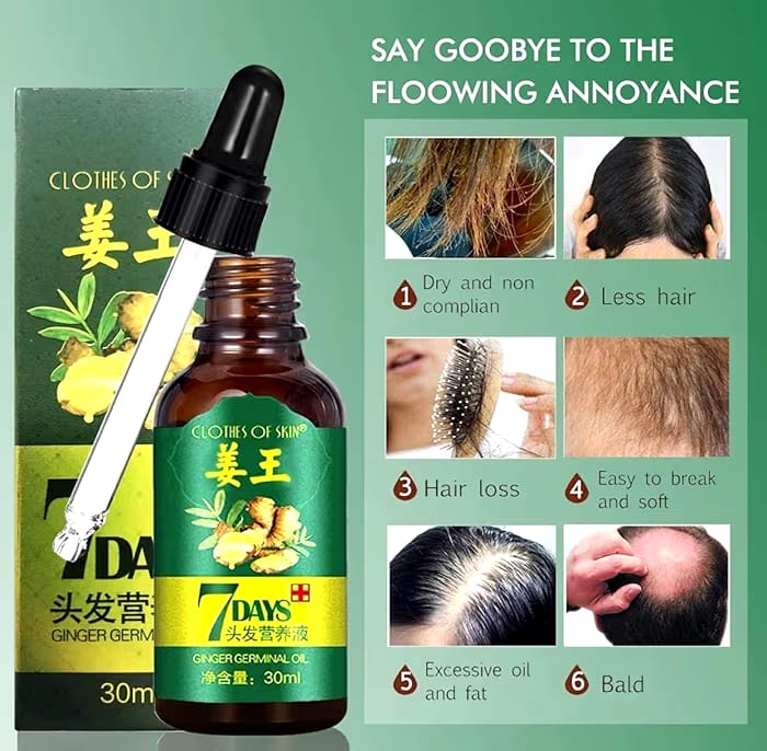 Hair Regrow 7 Day, Ginger Germinal Essential Oil Hair Growth Hair Loss Treatment Hair Care Hair Growth Serum for Men & Women, 30ml