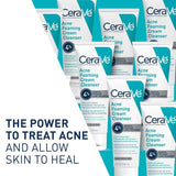 CeraVe Acne Foaming Cream Cleanser 150mL